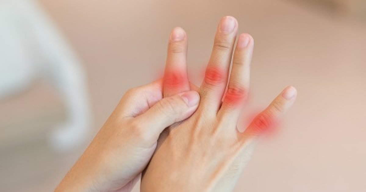 Mi az a Sindibis vírus, és mi köze a reumatológiához? | dr. Sütő Gábor