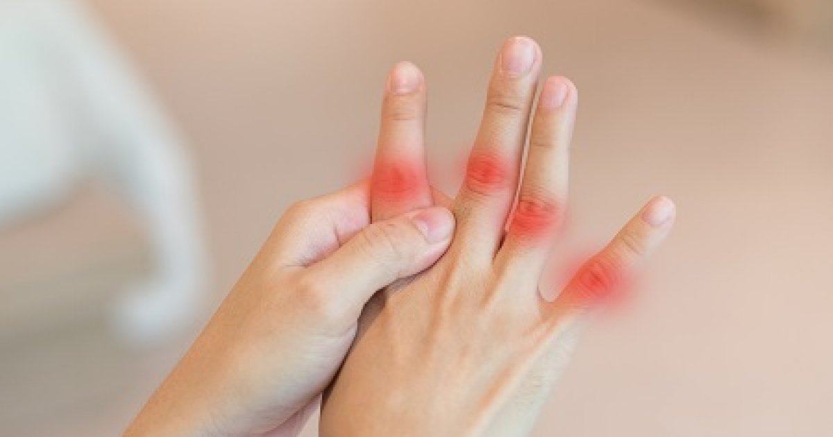 Az izomgyulladás (myositis) típusai, tünetei és kezelése