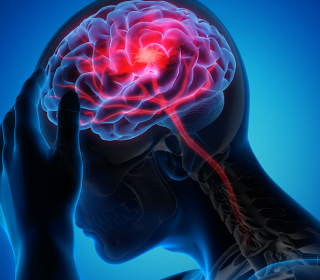 Epilepszia