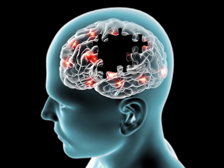 A koronavírus neurológiai szövődményei közt van a fejfájás és a tanulási nehézség is.