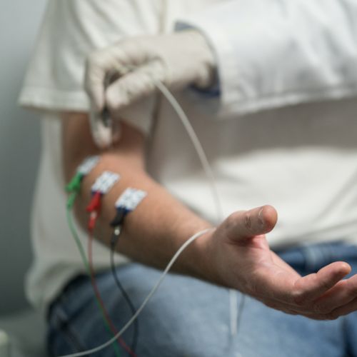 Kéz- karzsibbadás, gyengeség? Mellkaskimeneti szindróma is lehet - Neurológiai Központ