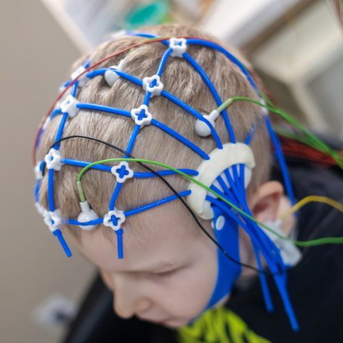 Holter EEG - Neurológiai Központ