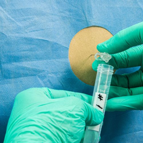 Sclerosis multiplex kivizsgálása - Neurológiai Központ